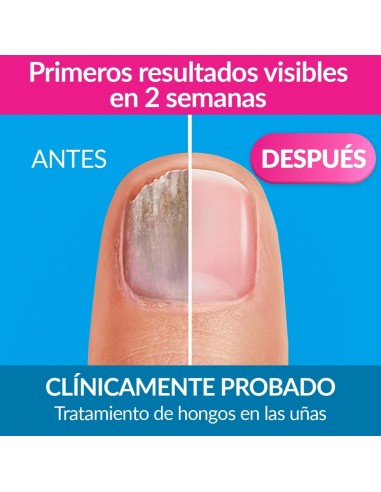 Excilor Esmalte Micosis Uñas 33 ml