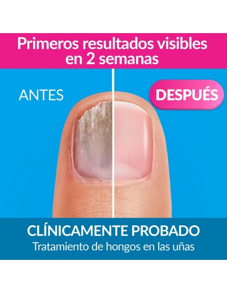 Excilor Esmalte Micosis Uñas 33 ml
