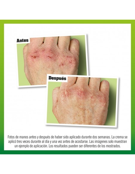 O´Keeffe´s Working Hands Crema para Manos Muy Secas y Agrietadas 96 g