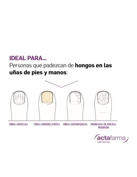 UnGeasil Esmalte Contra Hongos 3,5 ml