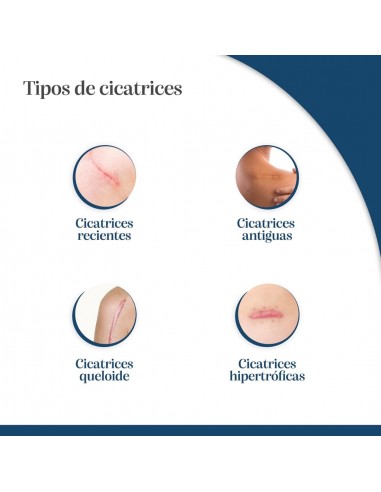 Trofolastin Elasticity Apósito Reductor de...