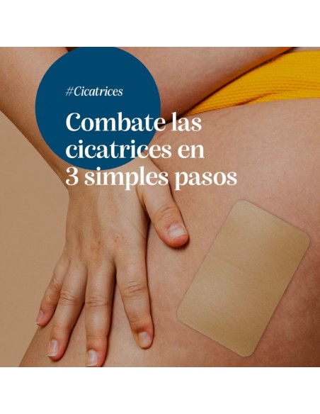 Trofolastin Elasticity Apósito Reductor de Cicatrices Recortable 5x7,5 cm - 5 unidades
