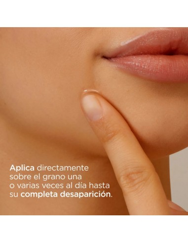 Isdin Acniben 3 Teen Skin On The Spot 15 ml