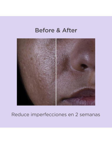Isdinceutics Salicylic Renewal Sérum 30 ml