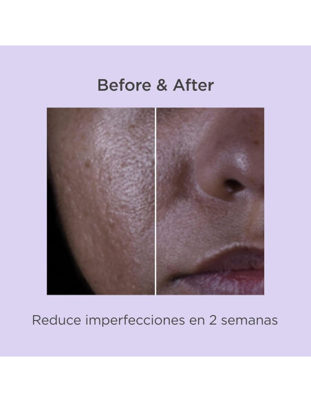 Isdinceutics Salicylic Renewal Sérum 30 ml