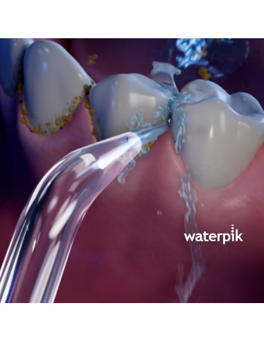 Waterpik Recambios Irrigador Boquilla Estándar...