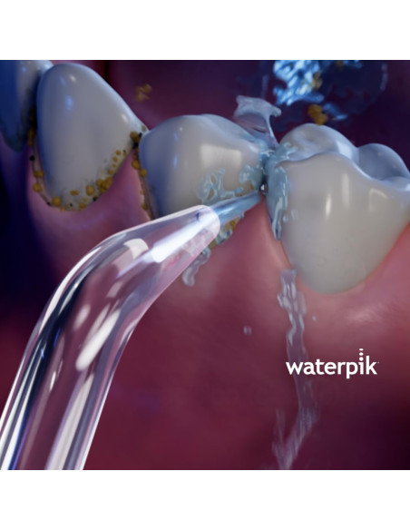 Waterpik Recambios Irrigador Boquilla Estándar para Modelos WP100/WP300/WP360/WP450 - 2 unidades