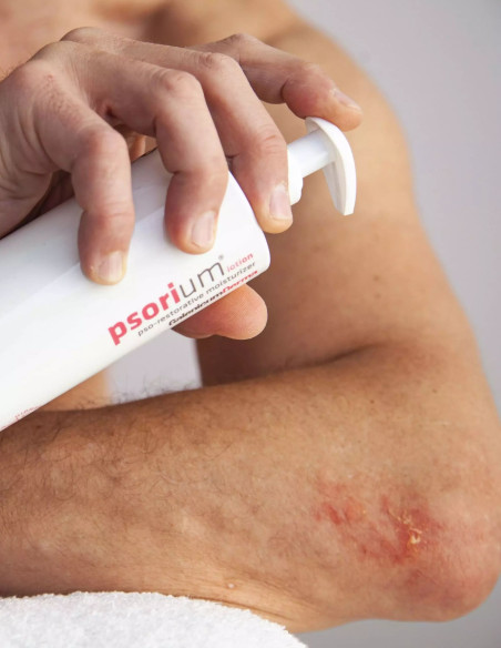 Galenicum Derma Psoriumm Loción Hidratante Corporal 400 ml