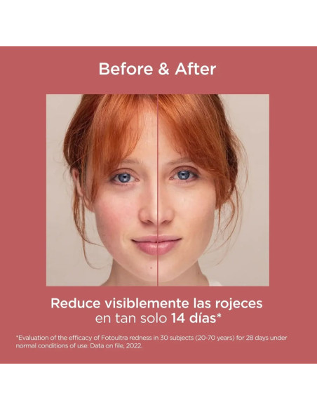Isdin FotoUltra Redness SPF 50 - 50 ml